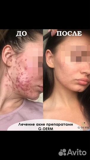 Косметология лица и тела