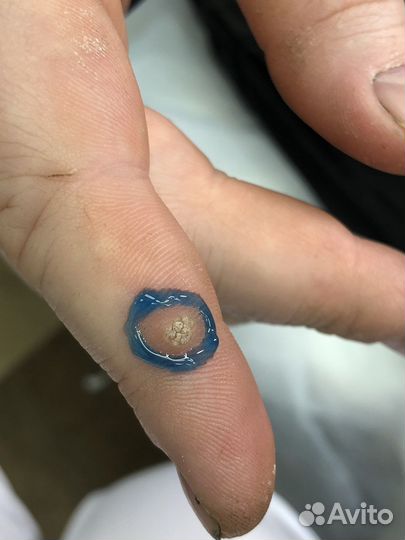 Подолог Мария Мусихина