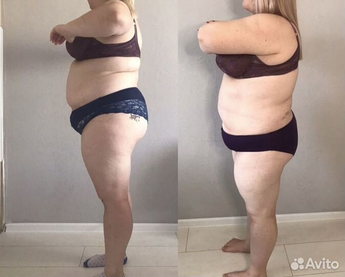 Вакуумный массаж для похудения