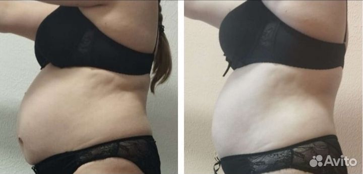 Массаж ручной/аппаратный (женщины и мужчины)