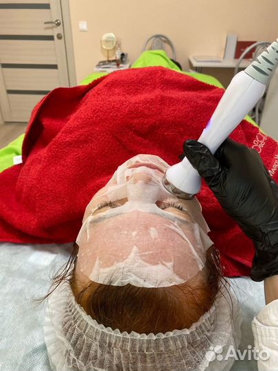 Смас лифтинг