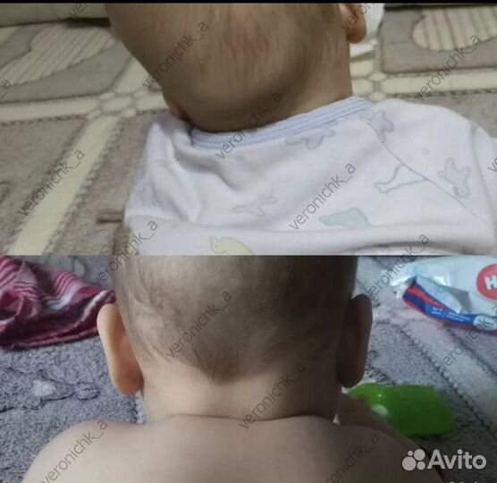 Детский массаж медик