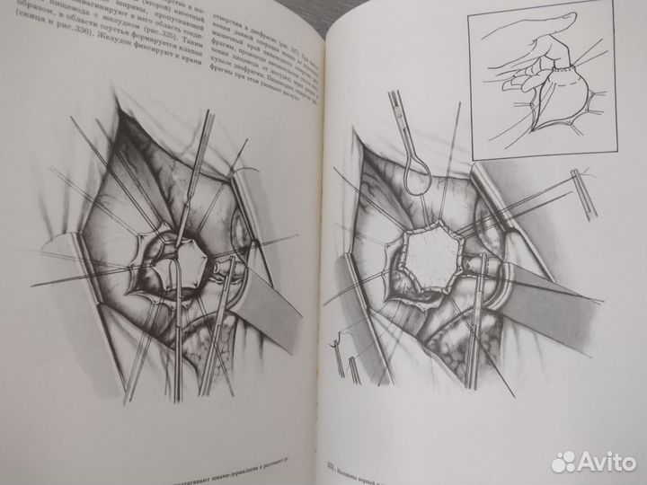 Книга по медицине атлас грудной хирургии 2 тома