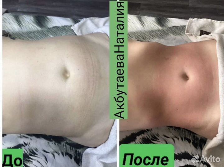 Антицилюлитный массаж, лазерная эпиляция, парнас