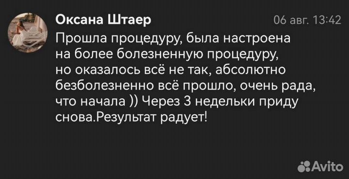 Модели на электро эпиляцию