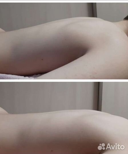 Биоэнергомассаж, массаж, с выездом на дом