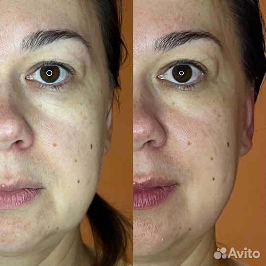 Массаж лица