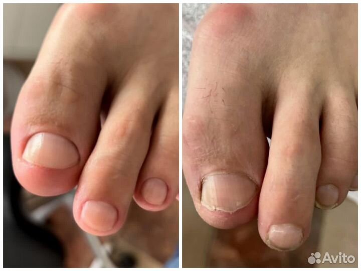 Мужской.Женский.Педикюр.Подолог