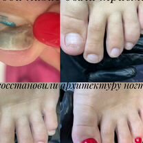 Подолог, Чебоксары