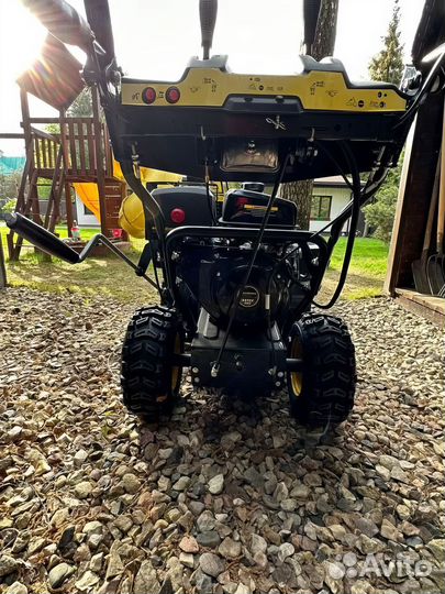 Снегоуборщик Champion ST1170E