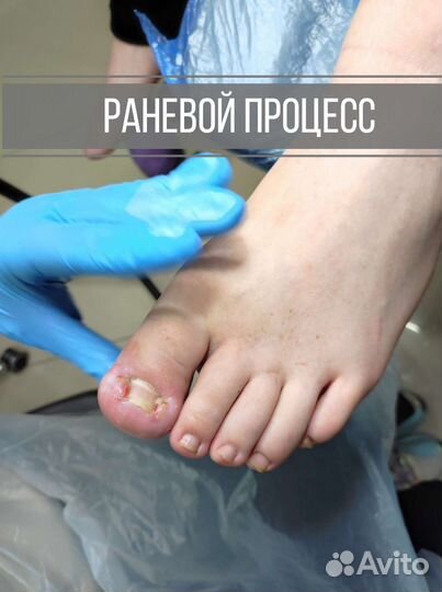 Услуги подолога