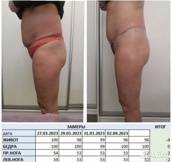 LPG-массаж тела/лица Orig аппарат опыт 15лет