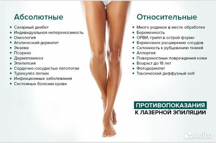 Лазерная эпиляция