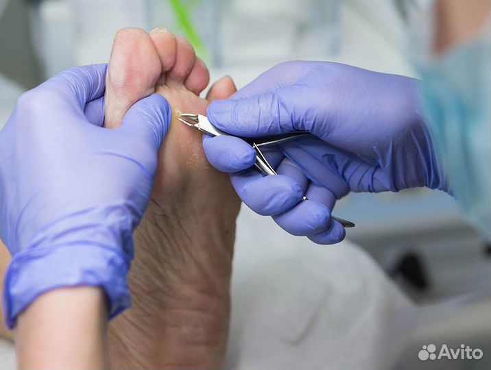Медицинский педикюр - Подолог