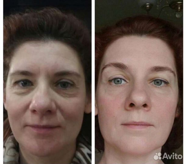 Фейсфитнес/Массаж лица/Фейслифтинг/Тренер/Пилатес