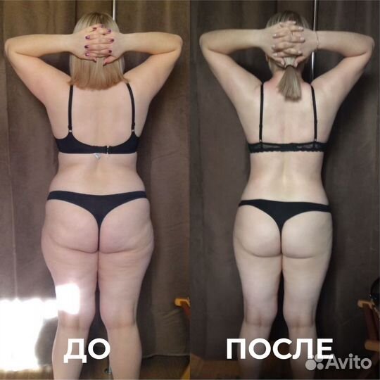 Послеродоваяя реабилитация ручная коррекция