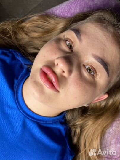 Увеличение губ