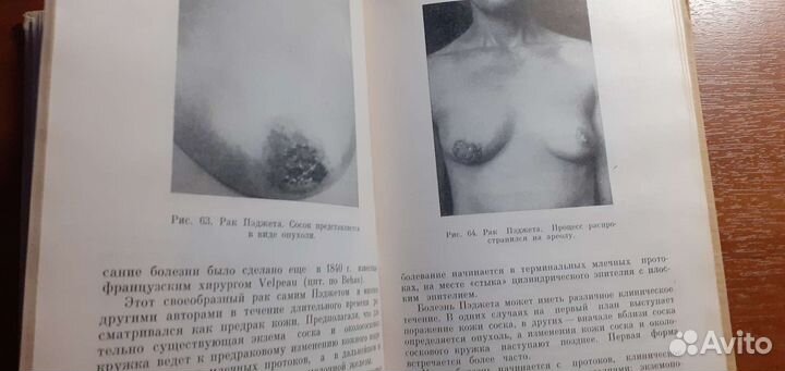 Рак молочной железы Янишевский Ф.И