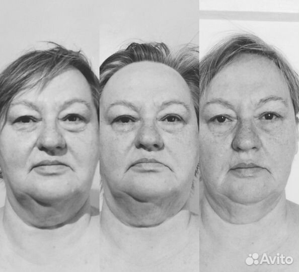 Специалист Витапластики Севастополь