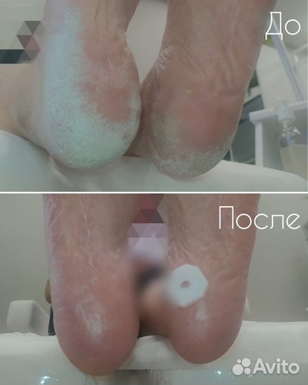 Подолог екатеринбург