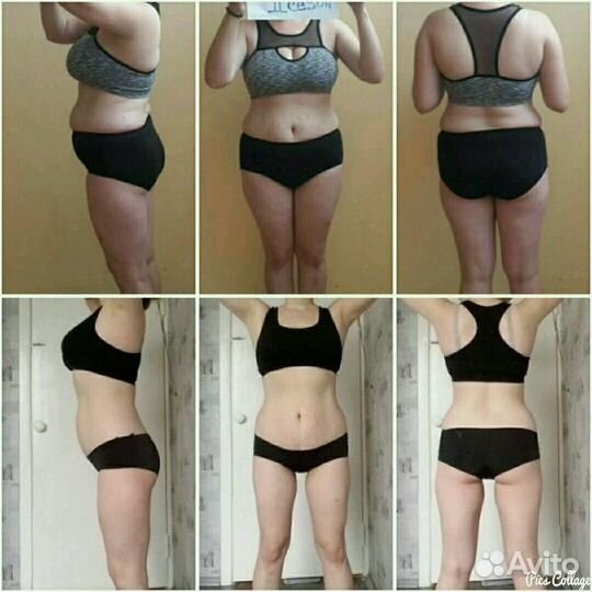 Вакуумно-роликовый массаж