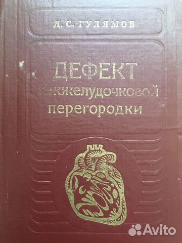 Дефект межжелудочковой перегородки фото