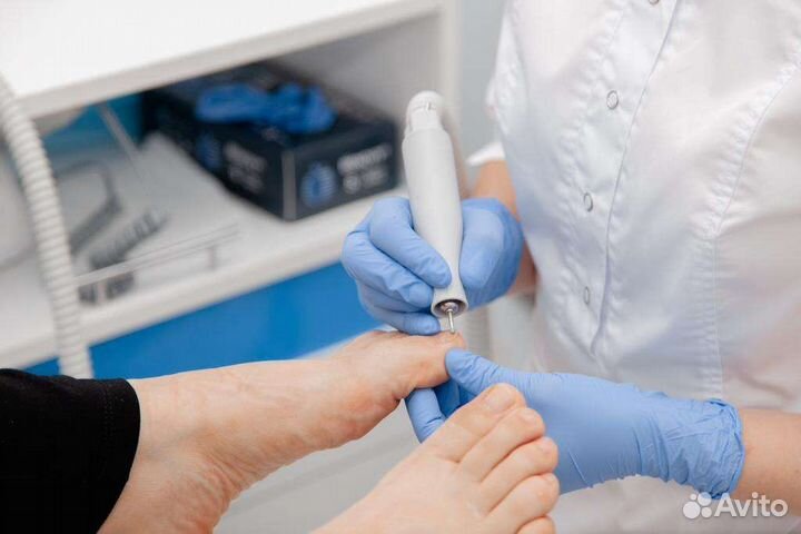 Лечебный педикюр