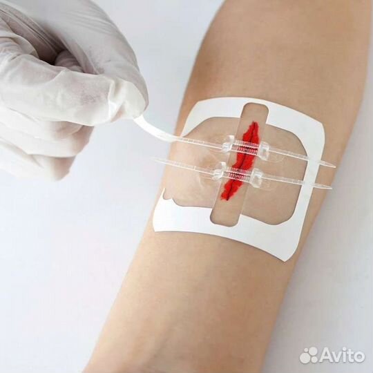 Устройство для стягивания ран