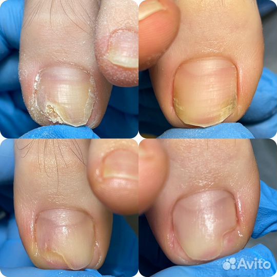 Подолог Волгоград