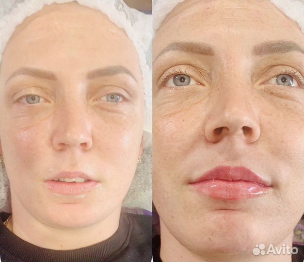 Косметология. Массаж «Эстетика тела»