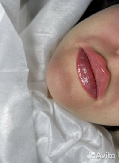 Консультация косметолога