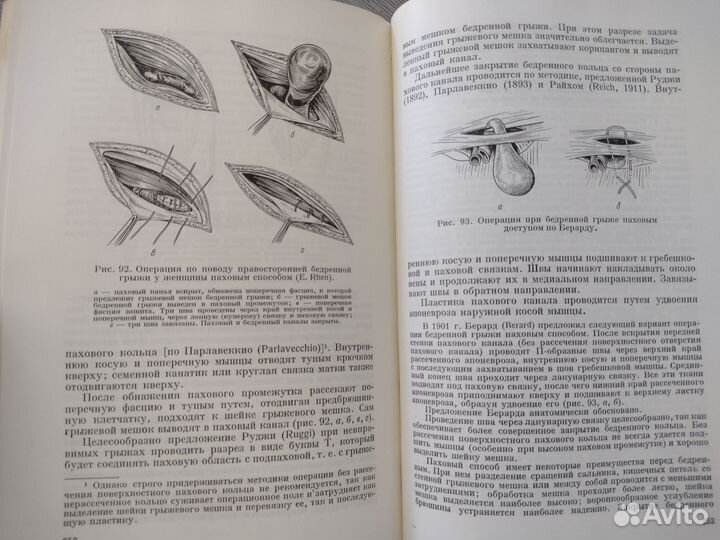 Книга по медицине Хирургия грыж брюшной стенки