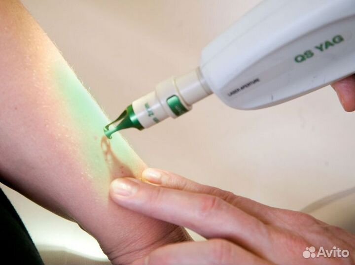 Готовый бизнес в бьюти-сфере – лазерная эпиляция