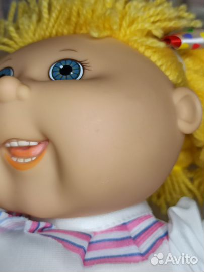 Cabbage patch kids