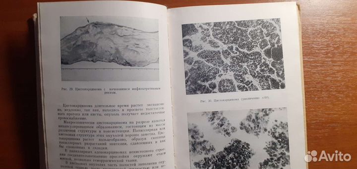 Рак молочной железы Янишевский Ф.И