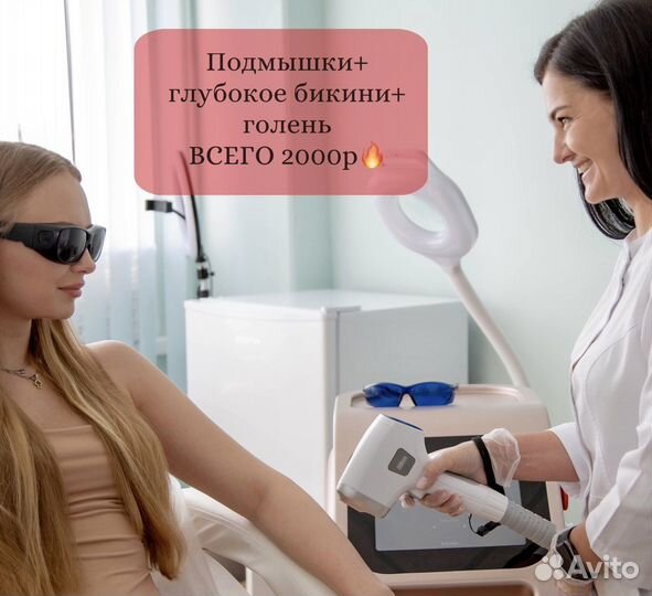 Лазерная эпиляция