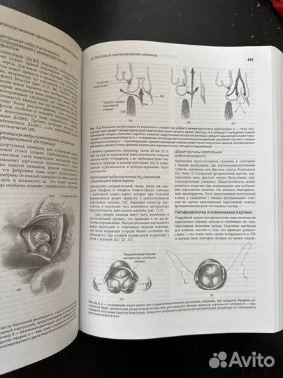 Хирургическое лечение врожденных пороков сердца