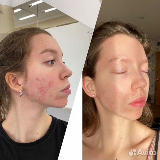 Уход за лицом