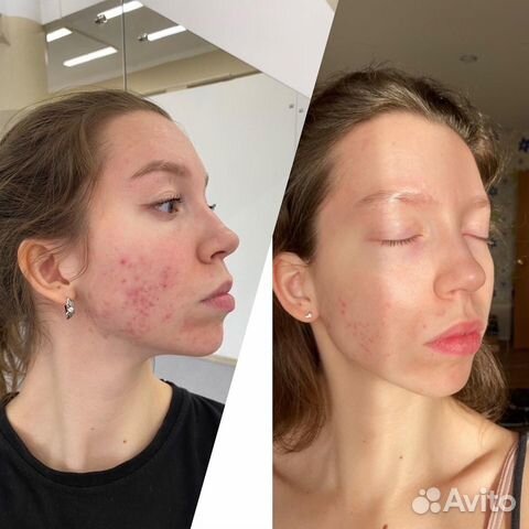 Уход за лицом