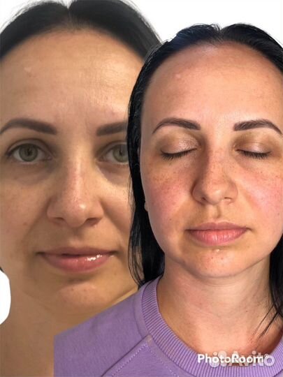 Скульптурный массаж лица