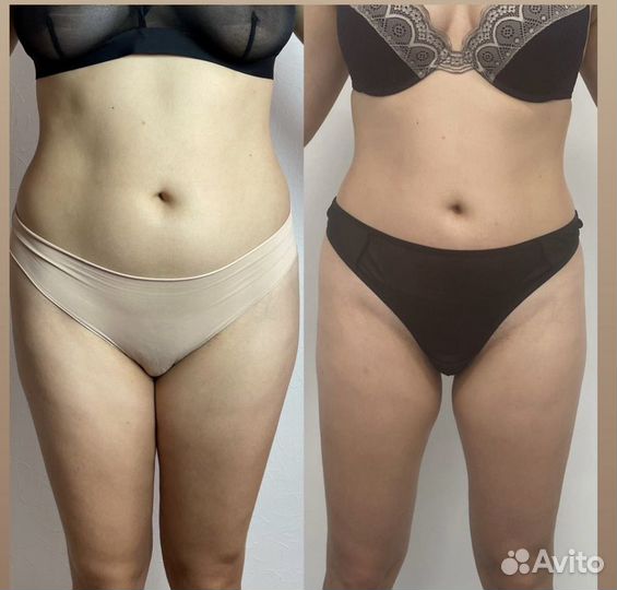 Массаж (общий,спины,антицеллюлитный)