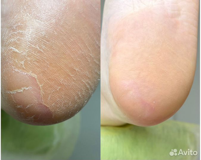 Модель на маникюр / педикюр