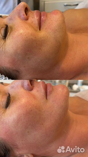 Косметолог Одинцово