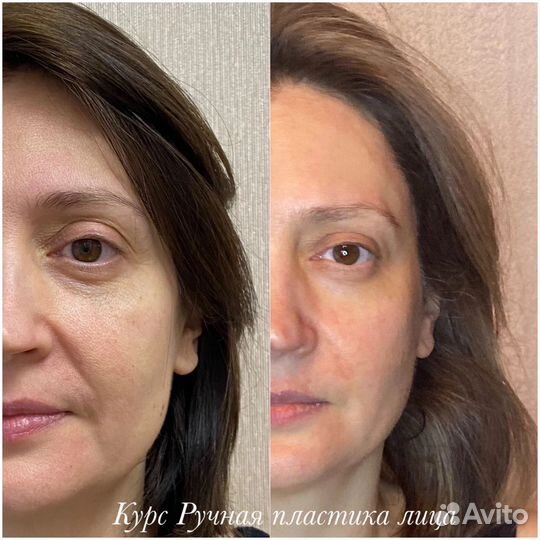 Обучение курсы массажа