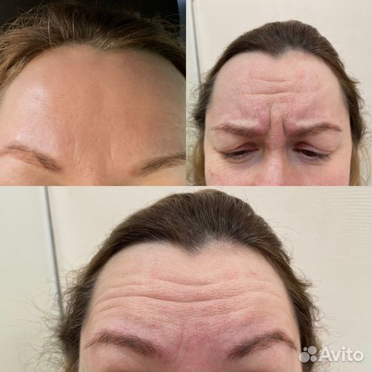 Косметология модели