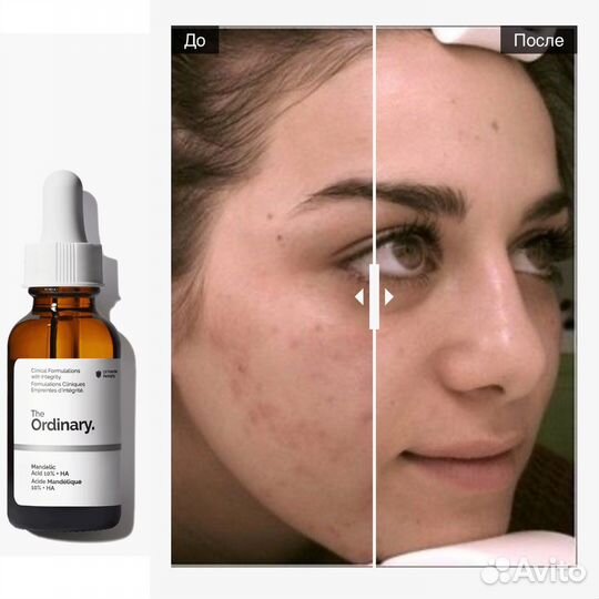 Сыворотка Zelens, Costa Brazil, Ordinary