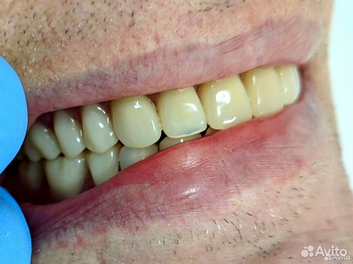 Зубной техник