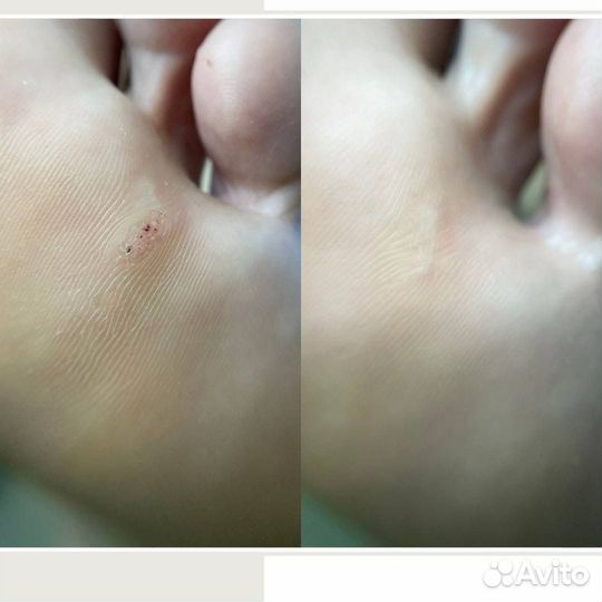 Услуги подолога