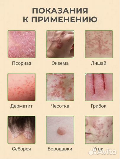 Тайская мазь от псориаза/Тайская косметика