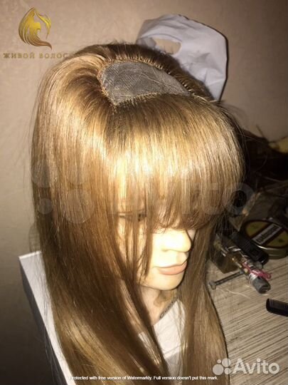 Парик система замещения на сетке